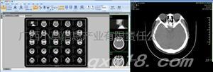 CT医学影像系统