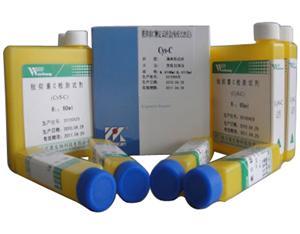 同型半胱氨酸诊断试剂盒等40余种诊断试剂盒